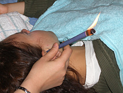 Ear candle
